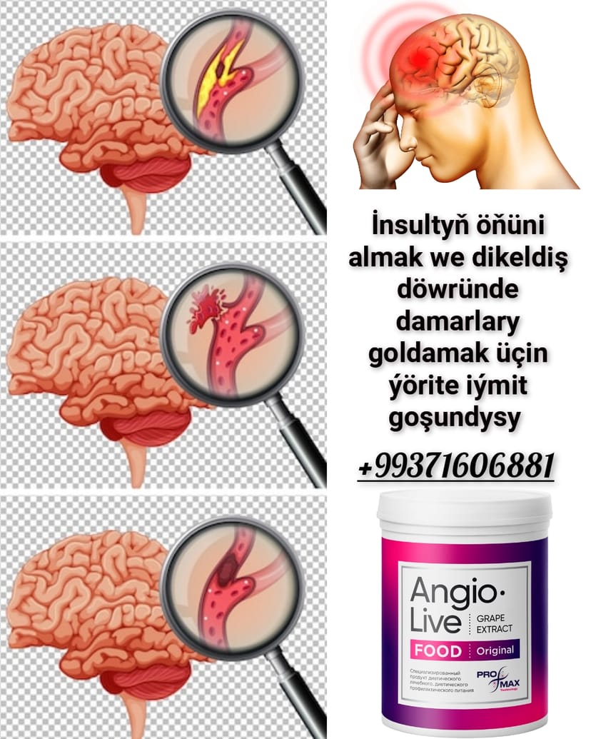 İnsultyň öňüni almak we keselden dikeliş döwründe size güýçli goldaw berjek tebigy Angio Live melhemi. Вертера Алфа