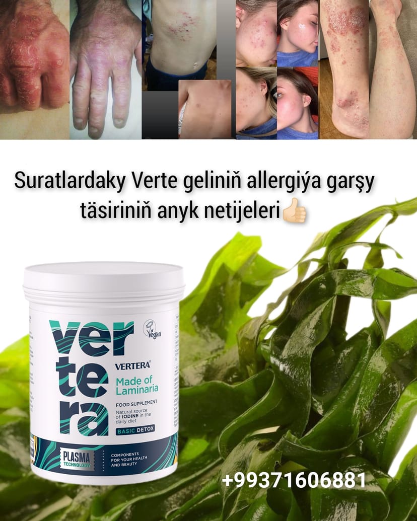 Allergiýa garşy deňiz melhemi Verte gel