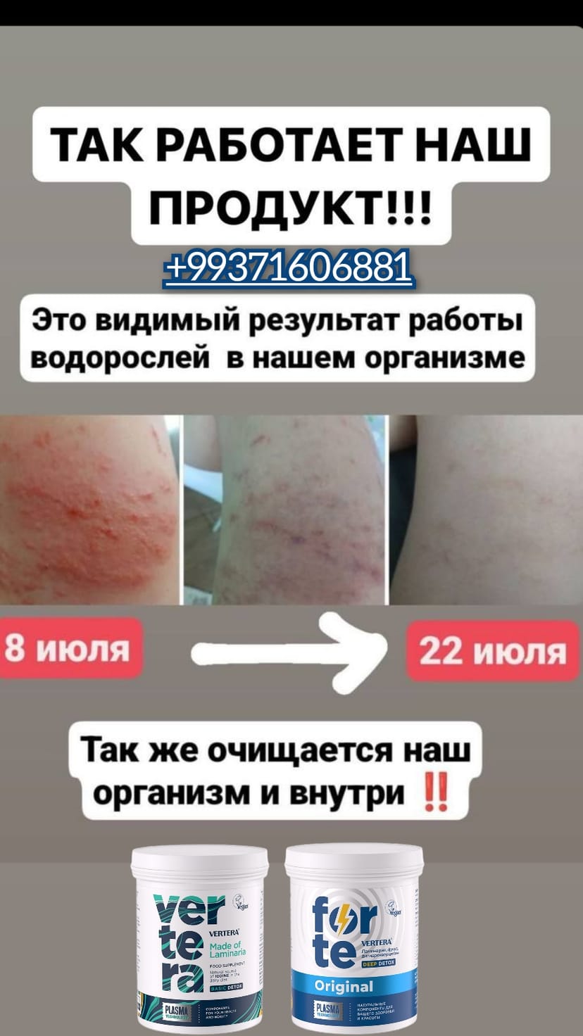 Allergiýa. Ekzema. Psoriaz. Vertera Turkmenistan. Verte geli. Forte Original