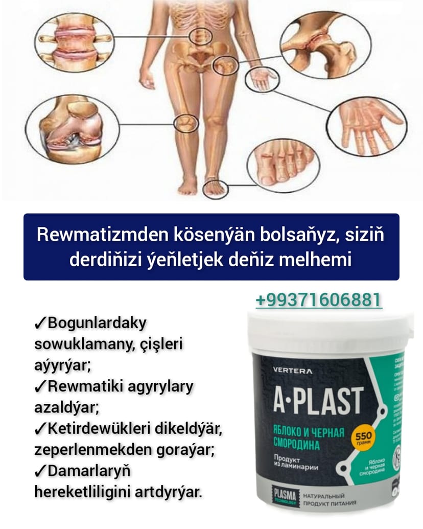 Rewmatizmden kösenýän bolsaňyz, derdiňizi ýeňletjek deňiz melhemi A-plast. Guragyry. Bogun agyry. Artrit. Artroz. Vertera Türkmenistan 