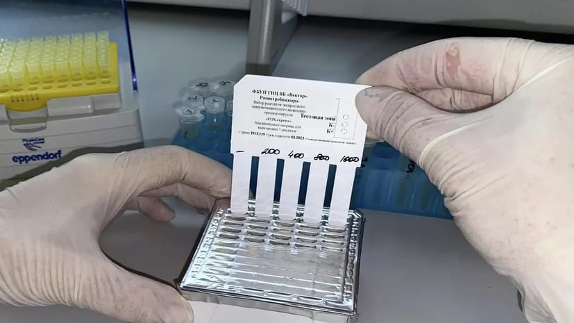 Rospotrebnadzor handed over to Turkmenistan test systems for the detection of monkeypox