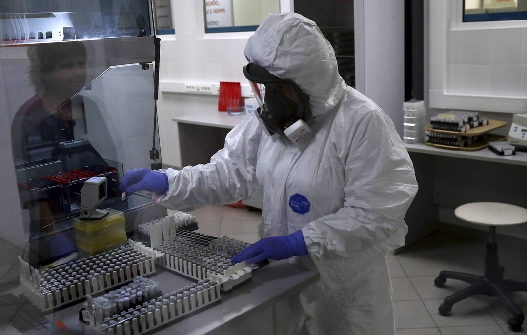 Russiýada COVID-19-a garşy antitelalary anyklamak üçin immunoferment barlag-testi işlenip taýýarlanyldy