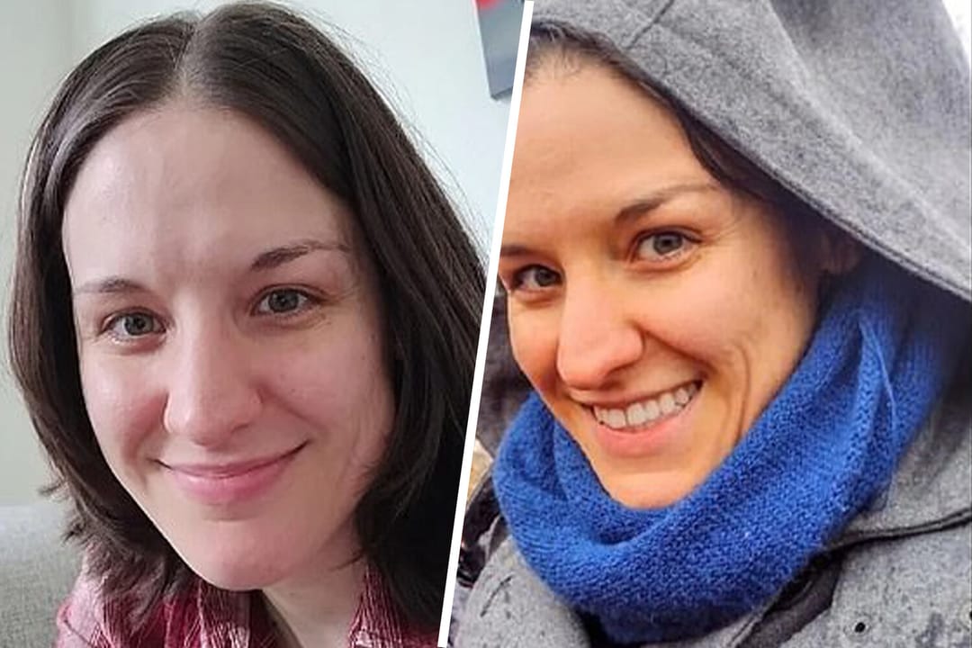 Her gün köp käşir iýen zenanyň ýüzi narynç reňk aldy