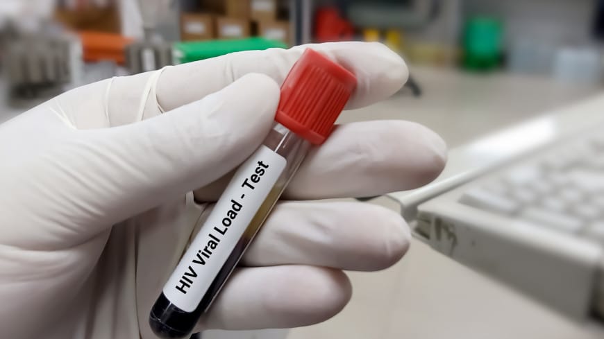 Fourth HIV cure in the world recorded in the United States