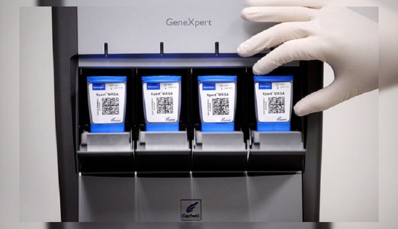 В Туркменистане проведен обучающий курс по использованию GeneXpert при тестировании на SARS-CoV-2