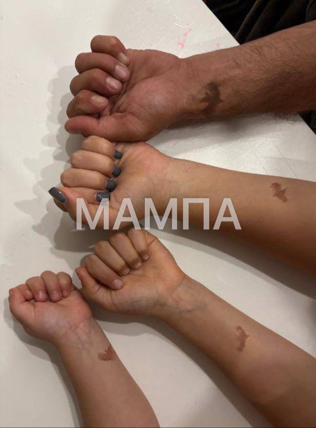 Russiýaly maşgaladaky dört çaganyň ýarganat şekilli meňi bar