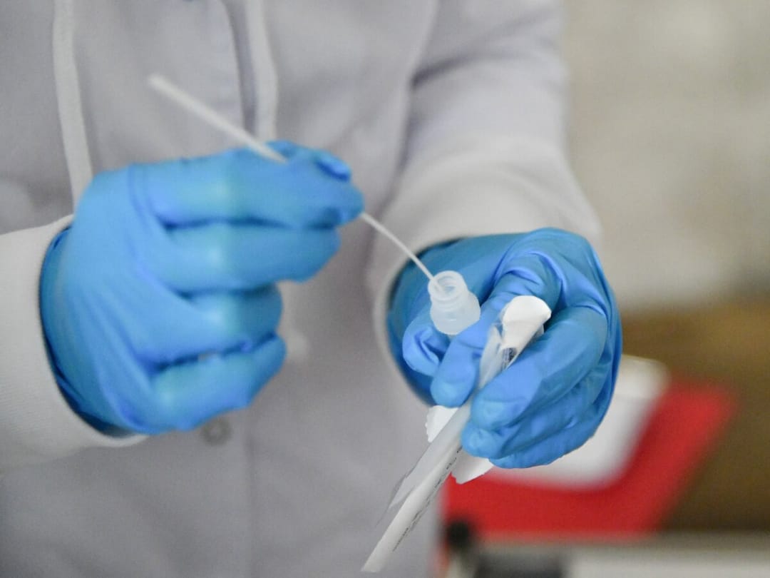 Russia will provide Turkmenistan with tests for the diagnosis of monkeypox