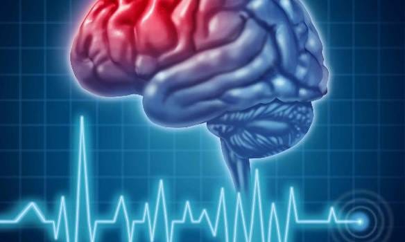 Реабилитация пациентов после инсульта