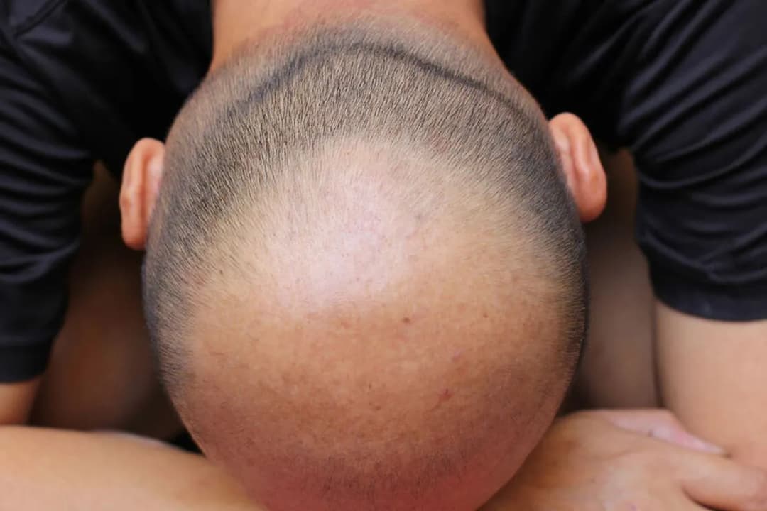 Zenan äriniň saçsyzdygyny gizländigi üçin polisiýa arza berdi