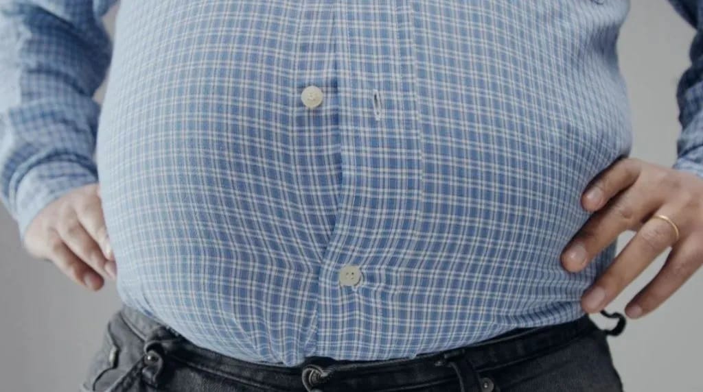 К 2050 году ожирение может затронуть более половины населения планеты