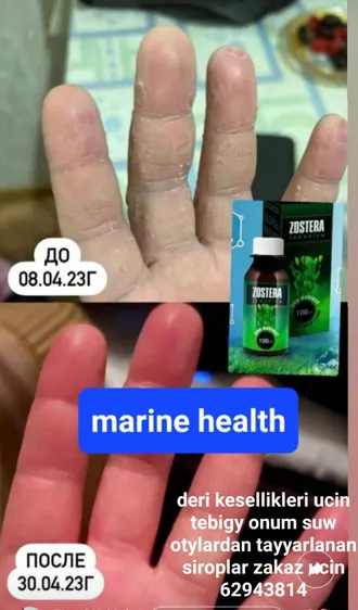 Marine health Tkm