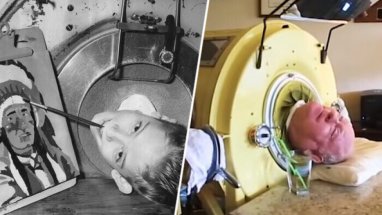 Paul Alexander, the man with the “iron lung”, has passed away