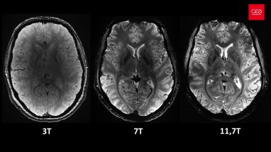 Fransa Atom Enerjisi ve Alternatif Enerjiler Kurumu, dünyanın en güçlü MRI cihazıyla elde edilen, insan beyninin en net görüntüsünü yayınladı