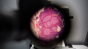 Ученые из Великобритании «заглянули» внутрь раковой клетки